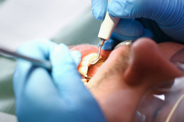 Best Emergency Tooth Extraction  in Winthrop, IA